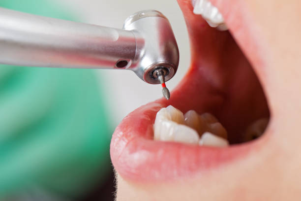 Best Emergency Treatment for Toothache in Kincaid, IL